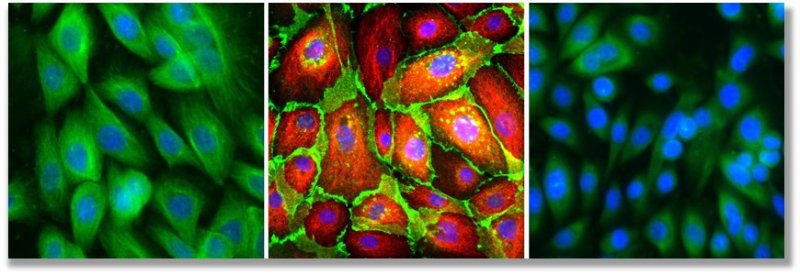 Fluorescence microscopy of Primary Cell cultures