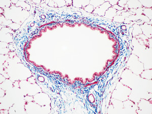 Animal Tissue Samples Masson's Trichrome Stain (Rat Airway Section)